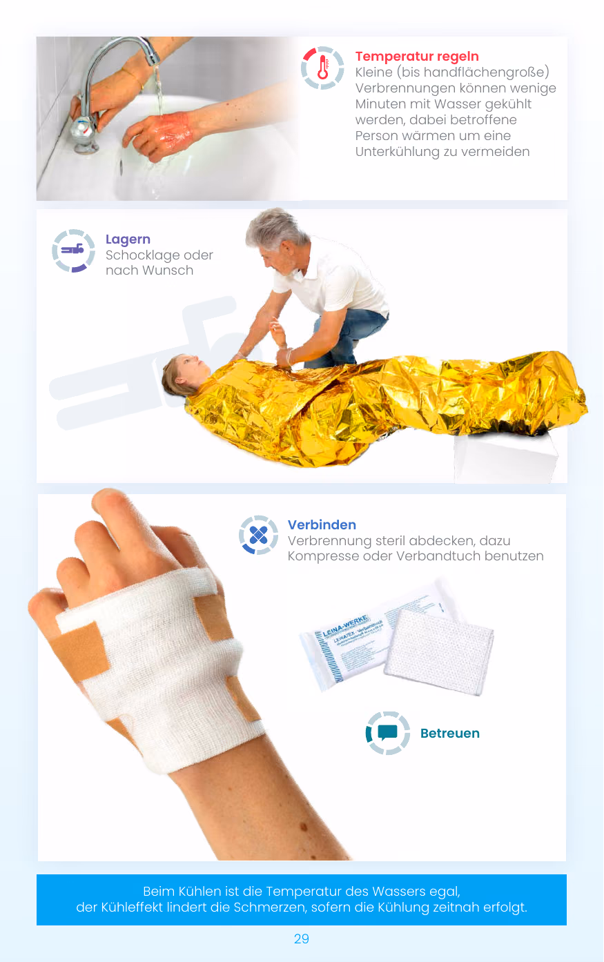 Maßnahmen bei Verbrennung: kühlen, lagern, verbinden